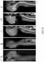 Fig. 07 - METHODS FOR DISTRIBUTING AGENTS TO AREAS OF BRAIN