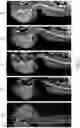 Fig. 10 - METHODS FOR DISTRIBUTING AGENTS TO AREAS OF BRAIN