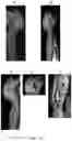 Fig. 11 - METHODS FOR DISTRIBUTING AGENTS TO AREAS OF BRAIN