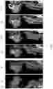 Fig. 12 - METHODS FOR DISTRIBUTING AGENTS TO AREAS OF BRAIN