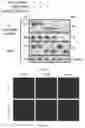 Fig. 04 - METHODS FOR TREATING NEUROMUSCULAR JUNCTION-RELATED DISEASES