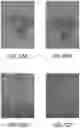 Fig. 17 - Compositions and methods for treating and preventing tissue injury and disease