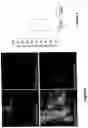 Fig. 07 - STRAIN OF LACTOBACILLUS ACIDOPHILUS HAVING ANALGESIC PROPERTIES IN THE GASTROINTESTINAL SYSTEM