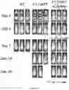Fig. 28 - Oncolytic virotherapy with helper-dependent adenoviral-based vectors expressing immunomodulatory molecules
