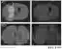 Fig. 01 - MALIGNANT TUMOR TARGET PEPTIDE