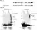 Fig. 02 - Compositions and methods for treatment of hereditary cystatin C amyloid angiopathy (HCCAA) and other neurodegenerative disorder associated with aberrant amyloid deposits