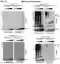 Fig. 03 - Compositions and methods for treatment of hereditary cystatin C amyloid angiopathy (HCCAA) and other neurodegenerative disorder associated with aberrant amyloid deposits