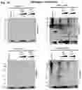 Fig. 05 - Compositions and methods for treatment of hereditary cystatin C amyloid angiopathy (HCCAA) and other neurodegenerative disorder associated with aberrant amyloid deposits