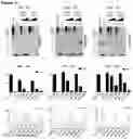 Fig. 08 - Compositions and methods for treatment of hereditary cystatin C amyloid angiopathy (HCCAA) and other neurodegenerative disorder associated with aberrant amyloid deposits