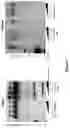 Fig. 11 - Compositions and methods for treatment of hereditary cystatin C amyloid angiopathy (HCCAA) and other neurodegenerative disorder associated with aberrant amyloid deposits