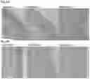 Fig. 12 - Compositions and methods for treatment of hereditary cystatin C amyloid angiopathy (HCCAA) and other neurodegenerative disorder associated with aberrant amyloid deposits