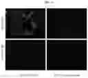 Fig. 04 - Compositions and methods for treating metabolic diseases