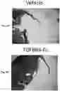 Fig. 12 - Methods for treating pulmonary hypertension with a ligand binding domain of a TGF-beta type II receptor