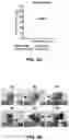 Fig. 03 - COMBINATION THERAPIES COMPRISING DENDRITIC CELLS-BASED VACCINE AND IMMUNE CHECKPOINT INHIBITOR