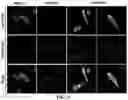 Fig. 08 - Gene and cell therapy using cell fusion technology