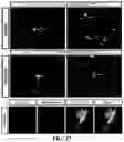 Fig. 15 - Gene and cell therapy using cell fusion technology