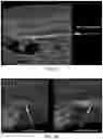 Fig. 09 - Imaging agents and methods of using the same