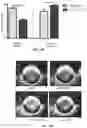 Fig. 18 - Esculentin 1a derivatives and uses thereof