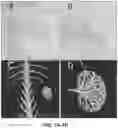 Fig. 08 - In situ solidifying solutions and methods of making and using thereof