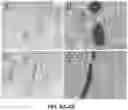 Fig. 09 - In situ solidifying solutions and methods of making and using thereof