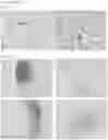 Fig. 04 - ELASTIN REDUCTION ALLOWING RECELLULARIZATION OF CARTILAGE IMPLANTS