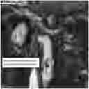 Fig. 01 - Settable bone void filler