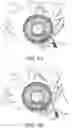 Fig. 05 - Minimally invasive VAD installation system and method