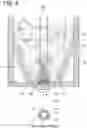 Fig. 06 - Dialysate solution container