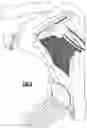 Fig. 10 - WEARABLE FLUID DELIVERY SYSTEM