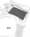 Fig. 16 - WEARABLE FLUID DELIVERY SYSTEM