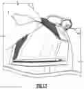 Fig. 18 - WEARABLE FLUID DELIVERY SYSTEM