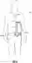 Fig. 20 - WEARABLE FLUID DELIVERY SYSTEM