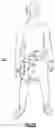 Fig. 24 - WEARABLE FLUID DELIVERY SYSTEM