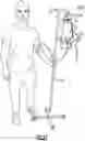 Fig. 28 - WEARABLE FLUID DELIVERY SYSTEM