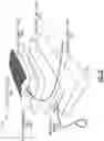 Fig. 34 - WEARABLE FLUID DELIVERY SYSTEM