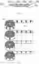 Fig. 06 - Inhalation Device for Administering Powdered Pharmaceutical Composition