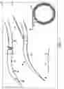 Fig. 02 - TRACHEOSTOMY PROCEDURE KITS AND GUIDING CATHETERS