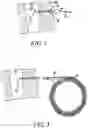 Fig. 03 - TRACHEOSTOMY PROCEDURE KITS AND GUIDING CATHETERS