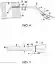 Fig. 04 - TRACHEOSTOMY PROCEDURE KITS AND GUIDING CATHETERS