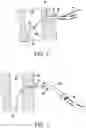 Fig. 05 - TRACHEOSTOMY PROCEDURE KITS AND GUIDING CATHETERS
