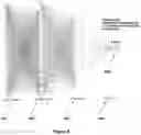 Fig. 05 - INFECTION RESISTANT CATHETER SYSTEM