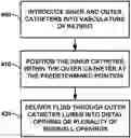 Fig. 01 - Aspiration catheter system