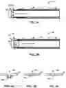 Fig. 03 - Aspiration catheter system