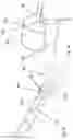 Fig. 19 - Steerable medical device handle
