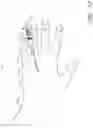 Fig. 13 - Securement device having an integral strap and dressing