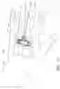 Fig. 17 - Securement device having an integral strap and dressing
