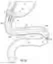 Fig. 09 - DELIVERY SYSTEMS FOR DEVICES WITH UNSUPPORTED STRUCTURE