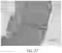 Fig. 26 - Components with high API loading