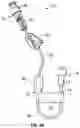 Fig. 07 - Extension set to reduce extension tube kinking