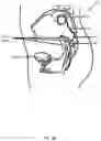 Fig. 06 - Antenna and methods of use for an implantable nerve stimulator